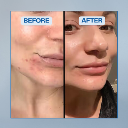 Dead Sea Mud Mask- Mineral-Rich Skincare from the Depths of the Dead Sea
