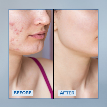 Dead Sea Mud Mask- Mineral-Rich Skincare from the Depths of the Dead Sea
